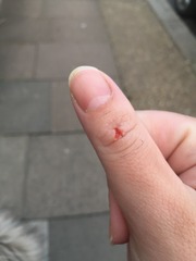 *Klaxon* I have a infected thumb