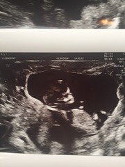 Thread #4 - TTC#1 the one where Stark joins the grads!!!!