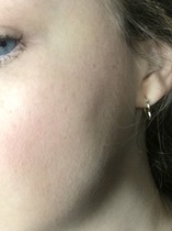 What Is This On My Face?!?!?