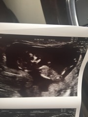 Thread #4 - TTC#1 the one where Stark joins the grads!!!!