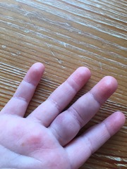 Do I take DD to A&E? (Pic)