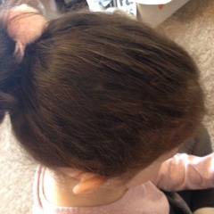 3yr old DD thinning hair - see photo