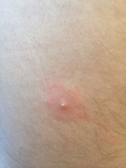 Spots - HELP!!!!