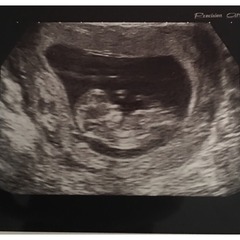 October 2016 (thread number four). Entering the second trimester.