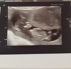 Staying posifrickentive- Thread 8 for ladies after mc