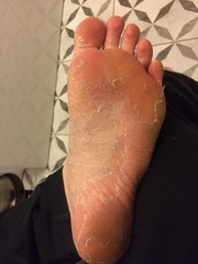 KLAXON! Does anyone want to see my feet?