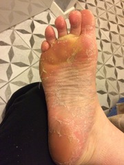 KLAXON! Does anyone want to see my feet?