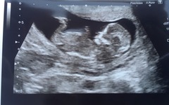 October 2016 (thread number four). Entering the second trimester.