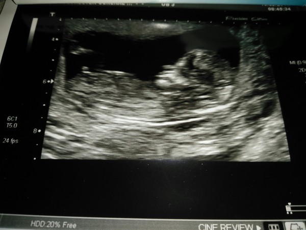 Thread #6 - TTC#1 Grads - Sun roasted pregnant ladies