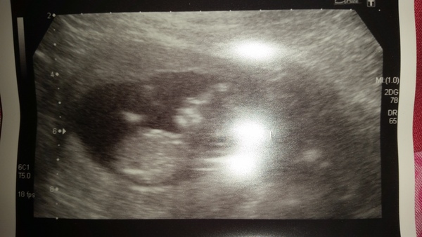 Staying posifrickentive- Thread 9 for ladies pg after mc