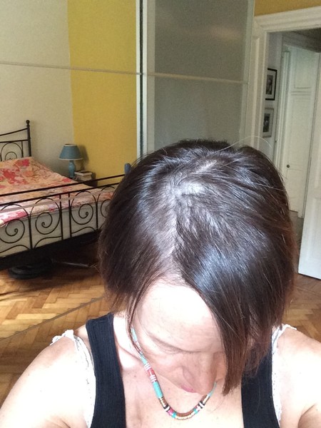 All the fives... Tamoxigang cancer support thread 55