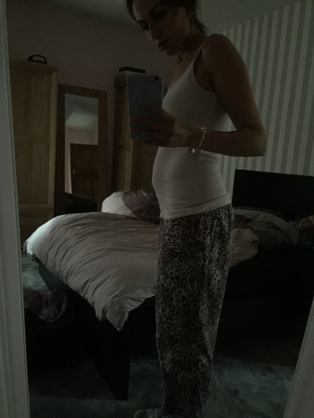 More scan waiting and symptom analysis from the December 2016 babies!