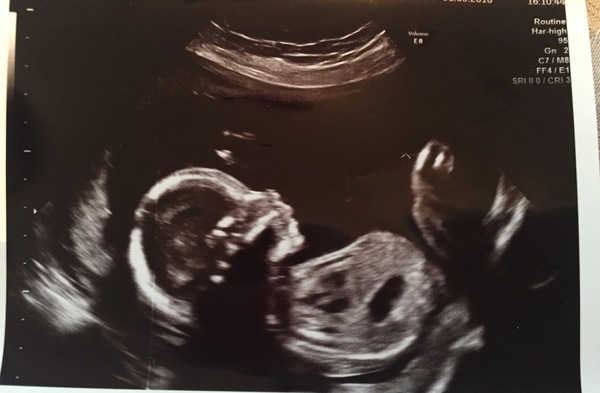 October 2016 (thread number four). Entering the second trimester.