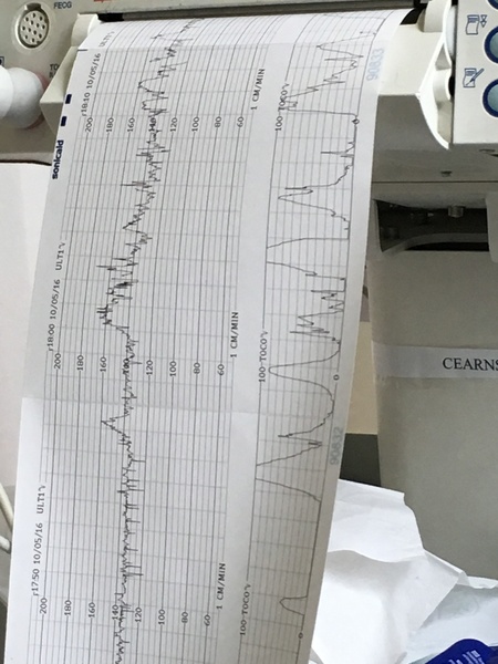 June #9, The ABSOLUTELY FINAL stretch! The one where the little ones start arriving. Here's to sleepless nights and lots of cuddles.