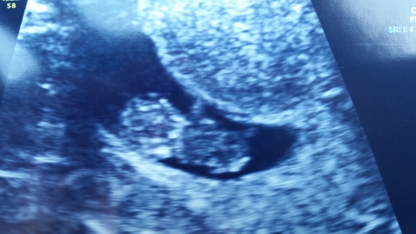 Staying posifrickentive- Thread 9 for ladies pg after mc