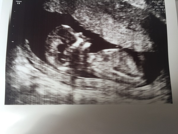 Any guesses a boy or girl? Need cheering up