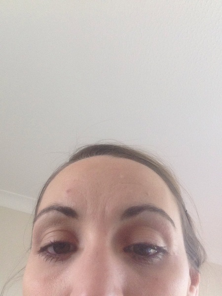 Botox, fillers or wrinkle cream (pic included)