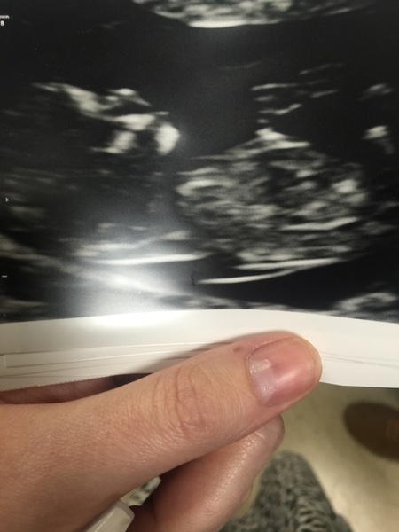 Thread #6 - TTC#1 Grads - Sun roasted pregnant ladies