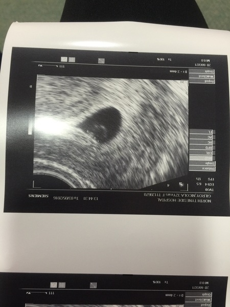 Late December - Early January '17 Babies