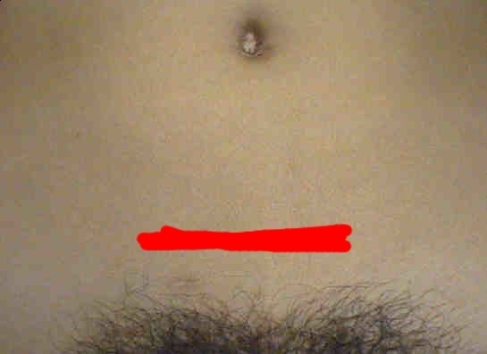 Early pregnancy, ridge above pubic bone (pic incl but not of me!!)
