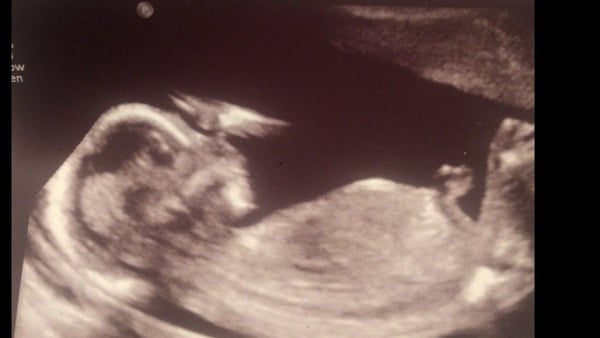 Babies due in November 2016 #4