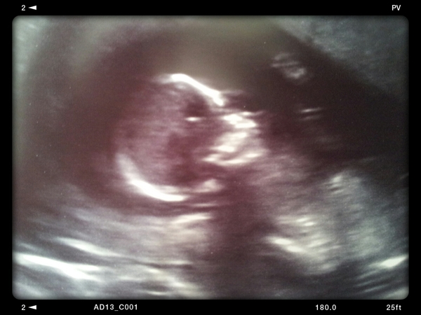 Thread #6 - TTC#1 Grads - Sun roasted pregnant ladies