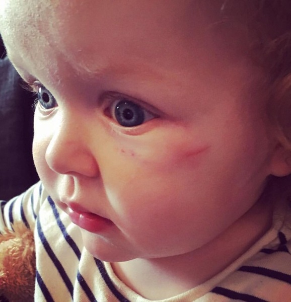 AIBU to think DD's nursery should have told me about this incident? (picture)