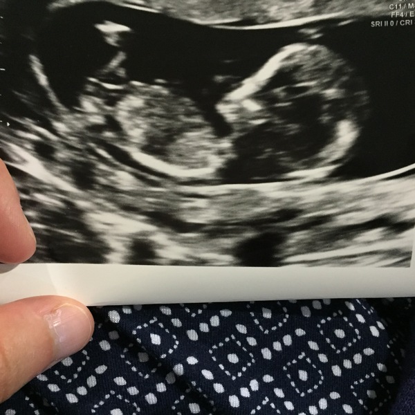 Thread #6 - TTC#1 Grads - Sun roasted pregnant ladies