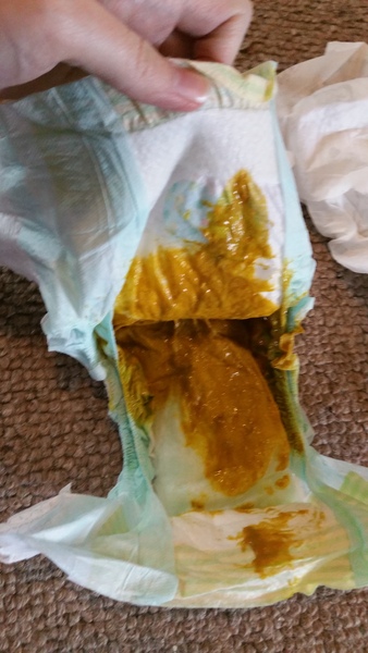Is this normal? Warning - nappy contents!