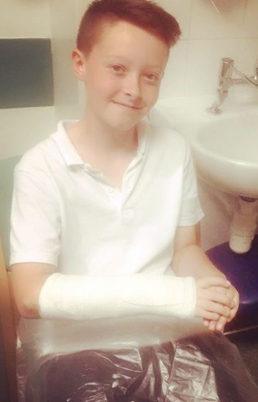 Do you think my son's wrist is broken?
