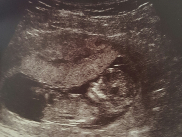 December due date buddies!