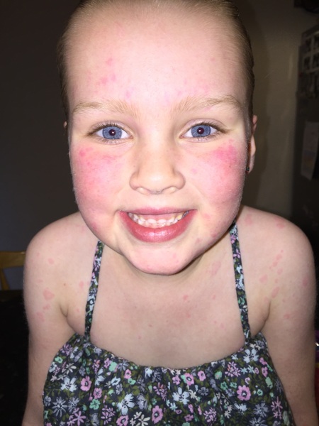 Has your child ever been misdiagnosed with growing pains?