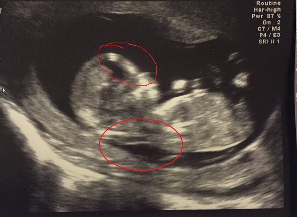 Could it be twins? Help needed please :)