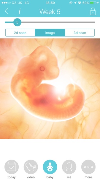 Morning sickness and first scan anticipation - it's the December 2016 babies.