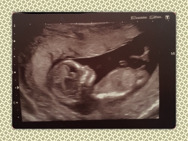 Gender B or G?