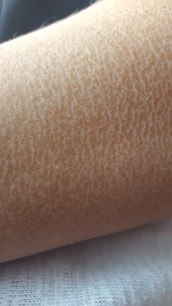 How do I stop my fake tan doing this...