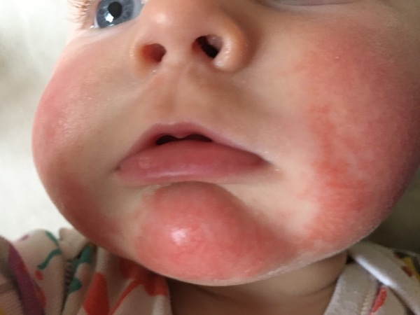 Does this look like an allergic reaction?