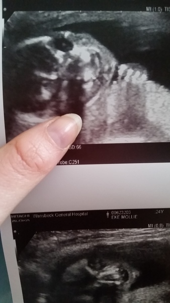 Thread #6 - TTC#1 Grads - Sun roasted pregnant ladies