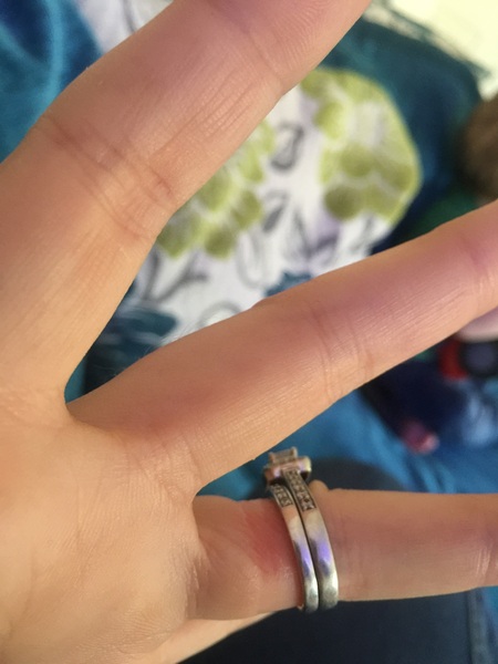 Baguette diamond wedding band cuts into my finger making it red and sore...why???