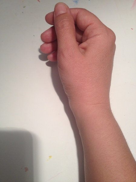 Should I have my wrist checked again?