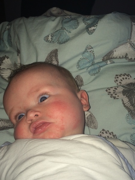 Does this look like an allergic reaction?