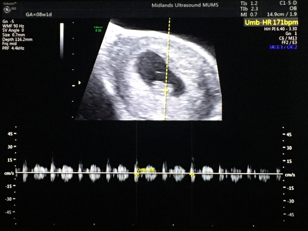 Morning sickness and first scan anticipation - it's the December 2016 babies.