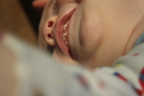 Any dentists about? 8mo has a black mark on a tooth and they don't look fully developed