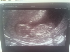 Going through IVF in February?