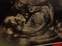 October 2016 (thread number four). Entering the second trimester.