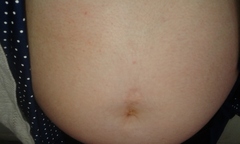 Belly spots?