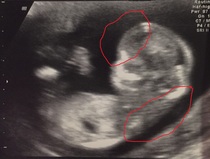 Could it be twins? Help needed please :)
