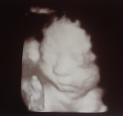 August 2016 number 5 - waddling towards the third trimester!