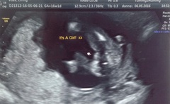 October 2016 (thread number four). Entering the second trimester.