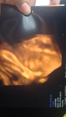 July 2016 Babies (8) - 3rd trimester here we come